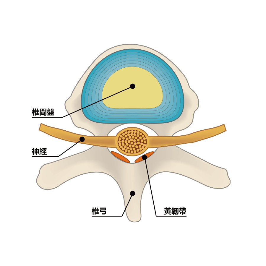 正常的椎間盤（側面図）